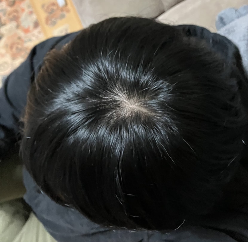 후면카메라