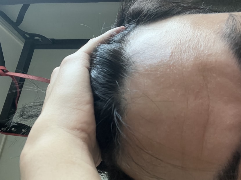 이마는 원래 쫌 많이 넓긴 했습니다