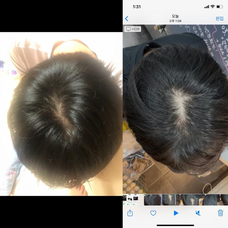 1년만에 정수리가 날라갔습니다 ㅠ