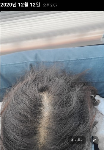 후 안정기