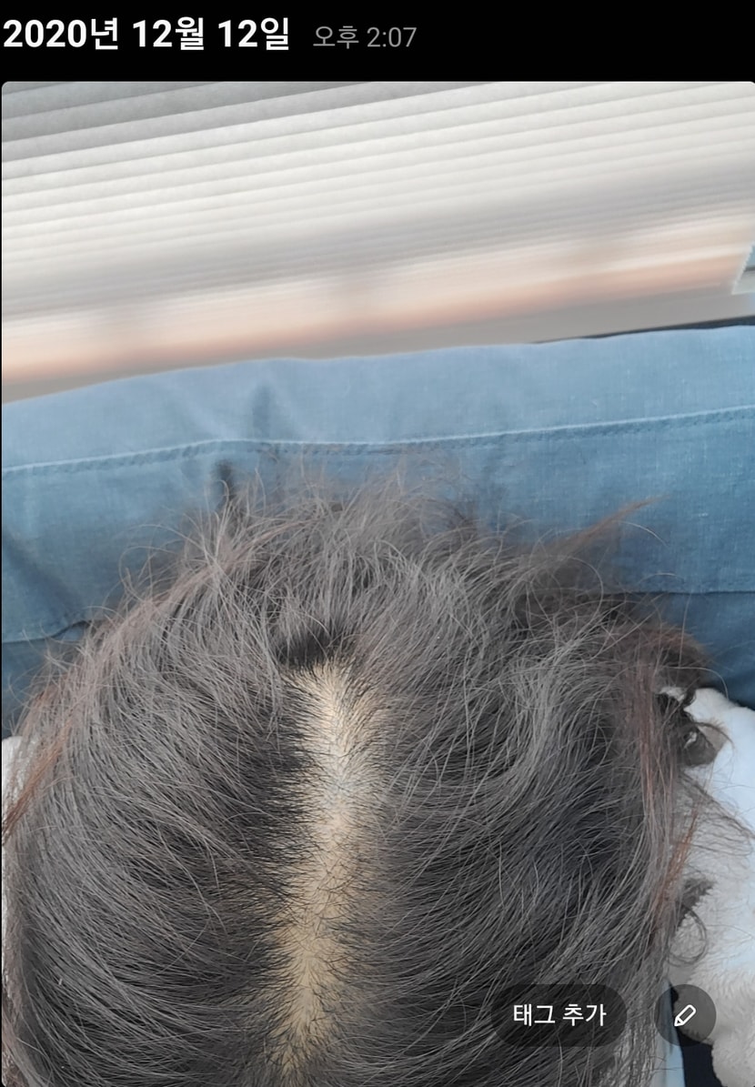 후 안정기