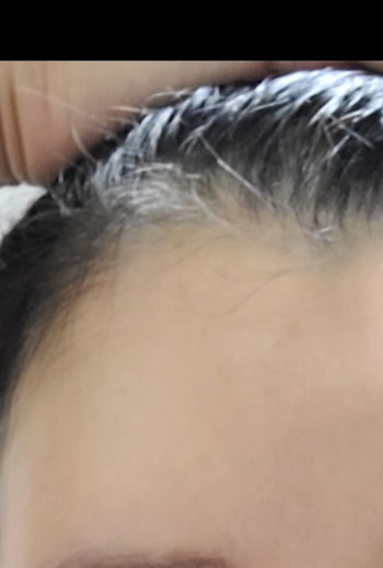 이마전