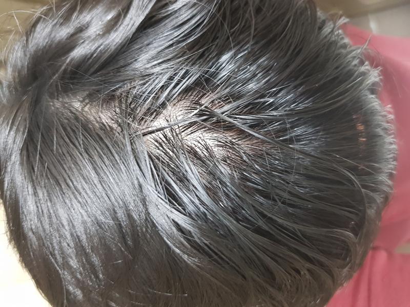 머리가 심하게 털리고 있어요..