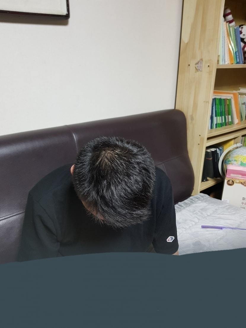 복용후(일년)
