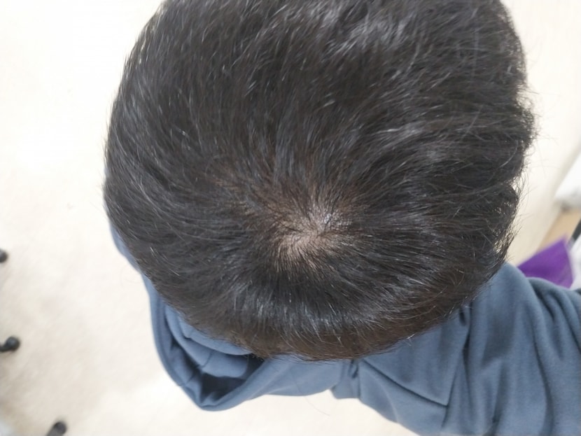1년전