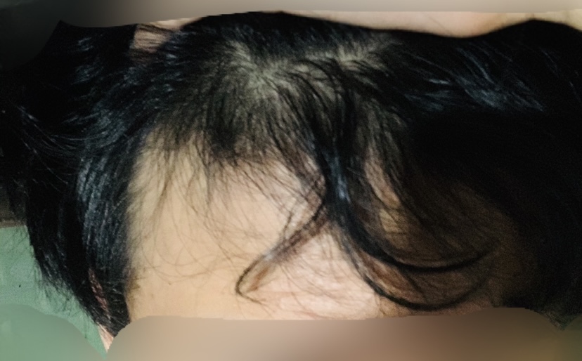 1년전 사진입니다