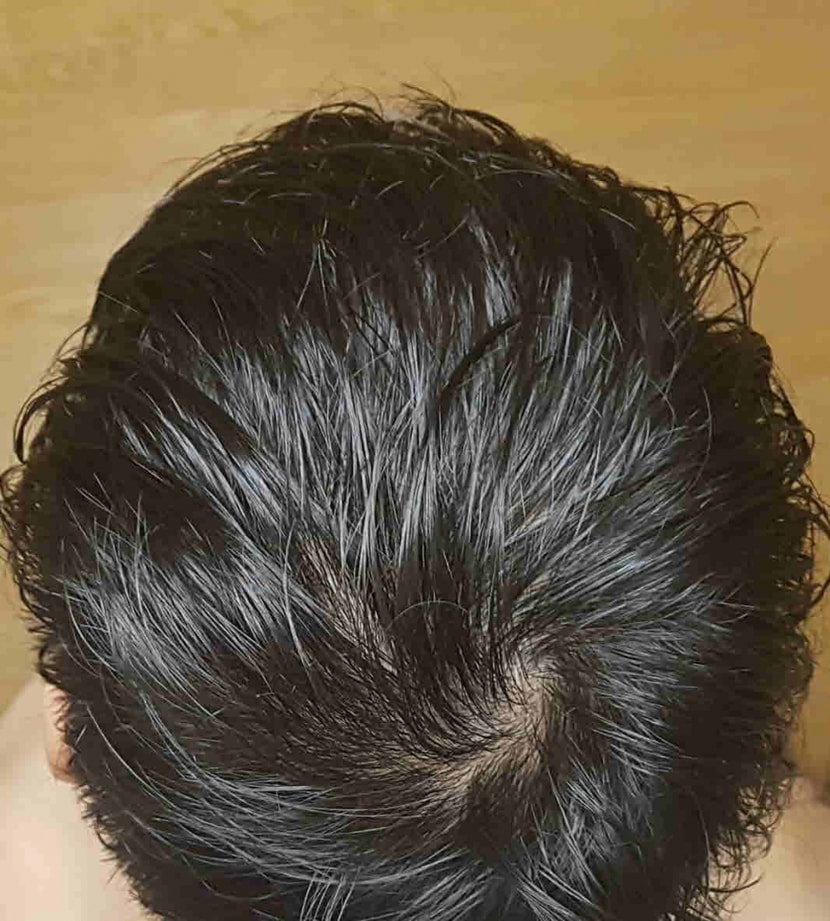 샤워 후 물기 있는 상태에서 바로찍은 사진