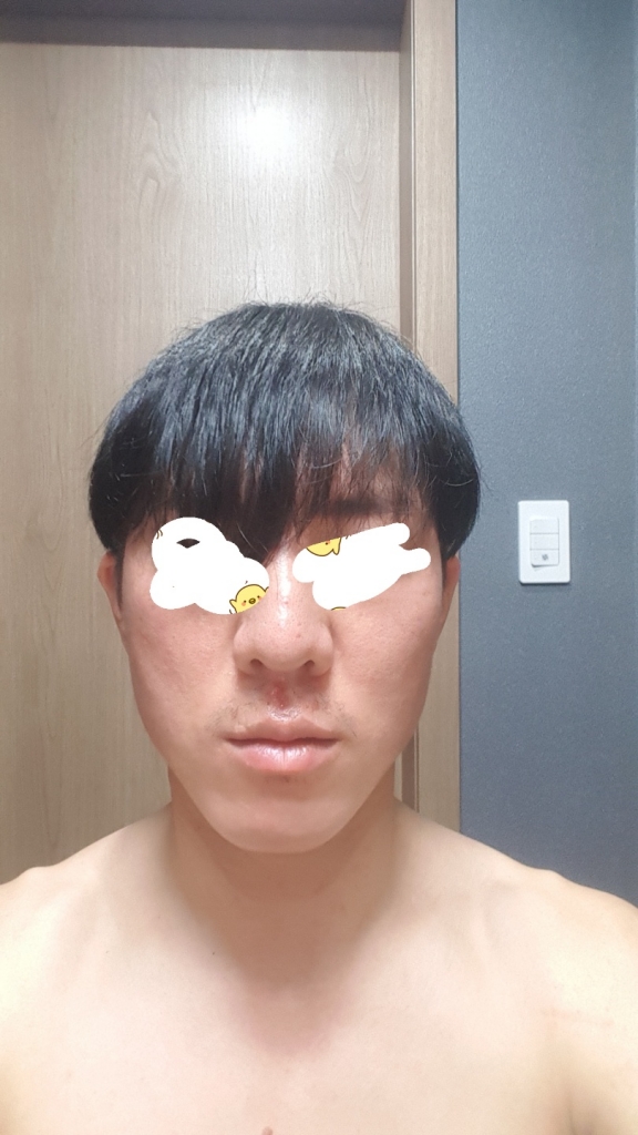 앞머리숱