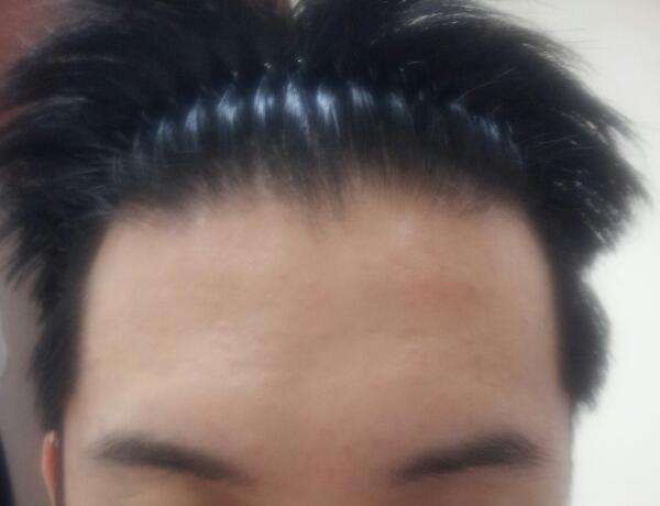 정면1