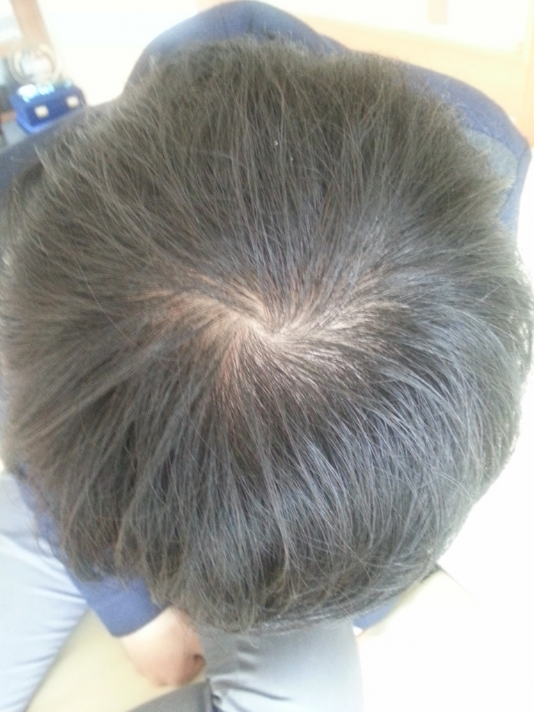 14년 2월 16일 4개월 차