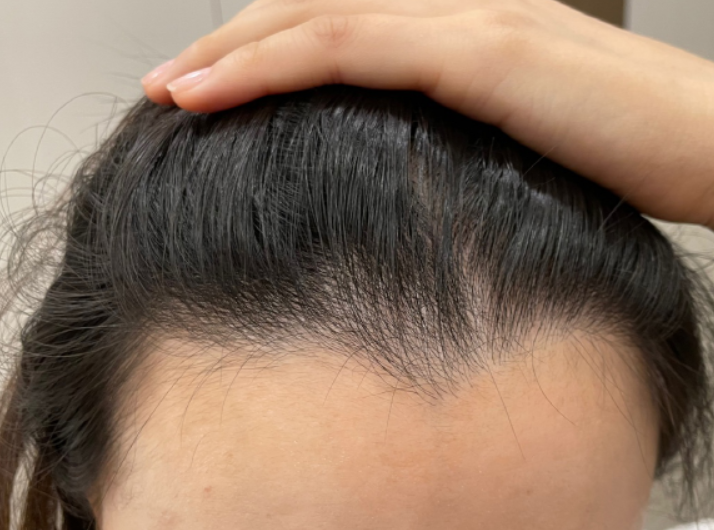 치료 받기 전 사진