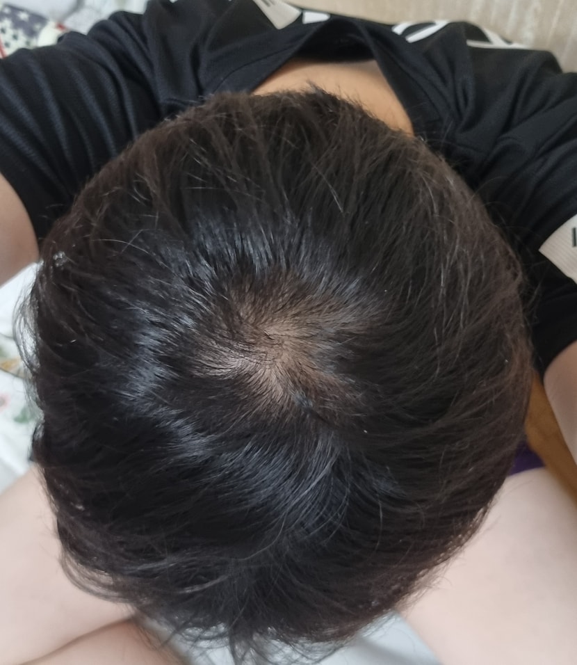 현재 머리