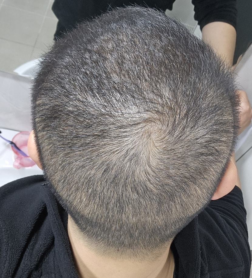 2달전