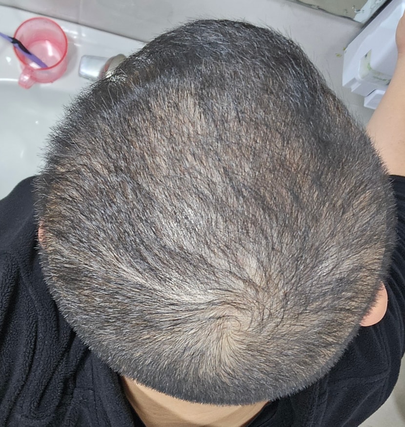 2달전