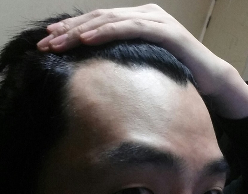 왼쪽
