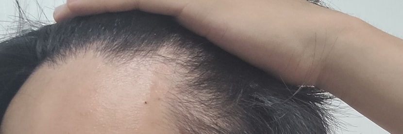 오른쪽