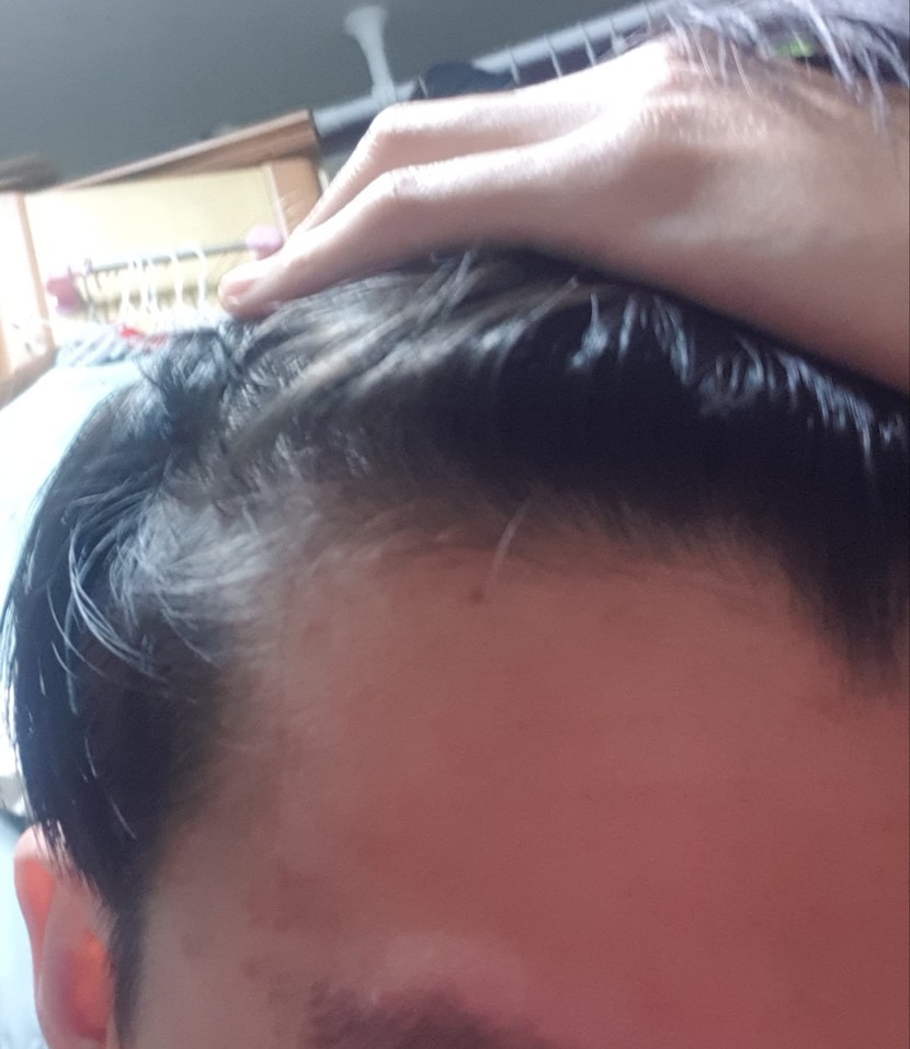 복용중