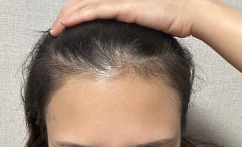 4달 지금
