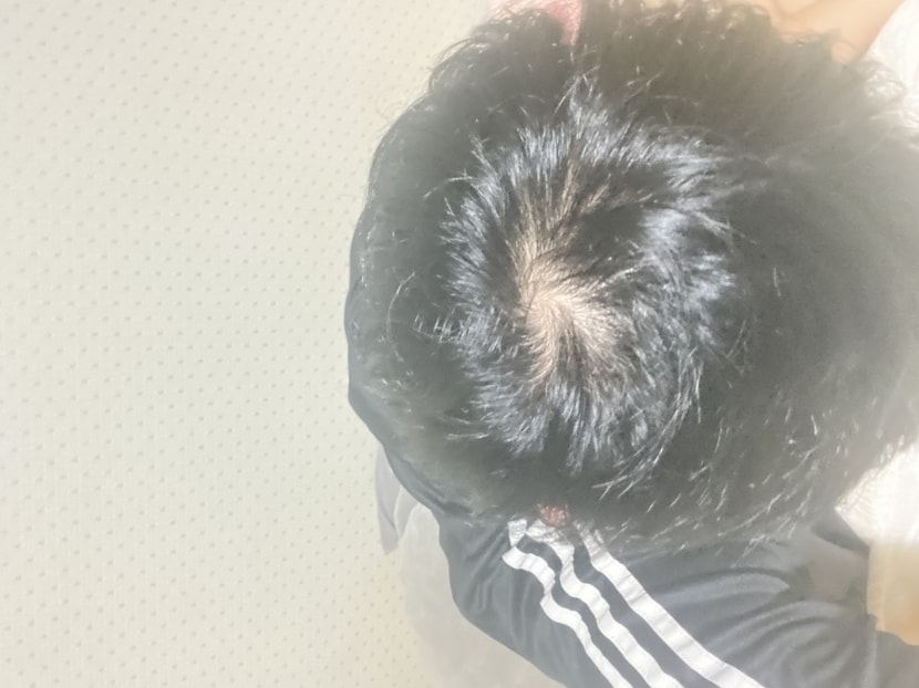 정수리