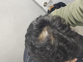 휴 4 회 8회 12회 경과 보겠습니다 다들 화이팅