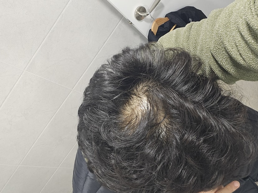 휴 4 회 8회 12회 경과 보겠습니다 다들 화이팅