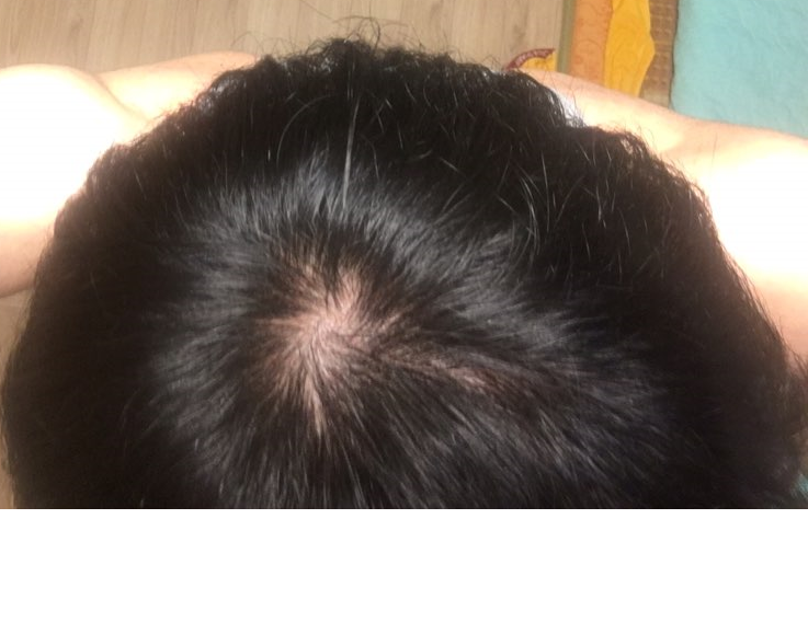 에휴