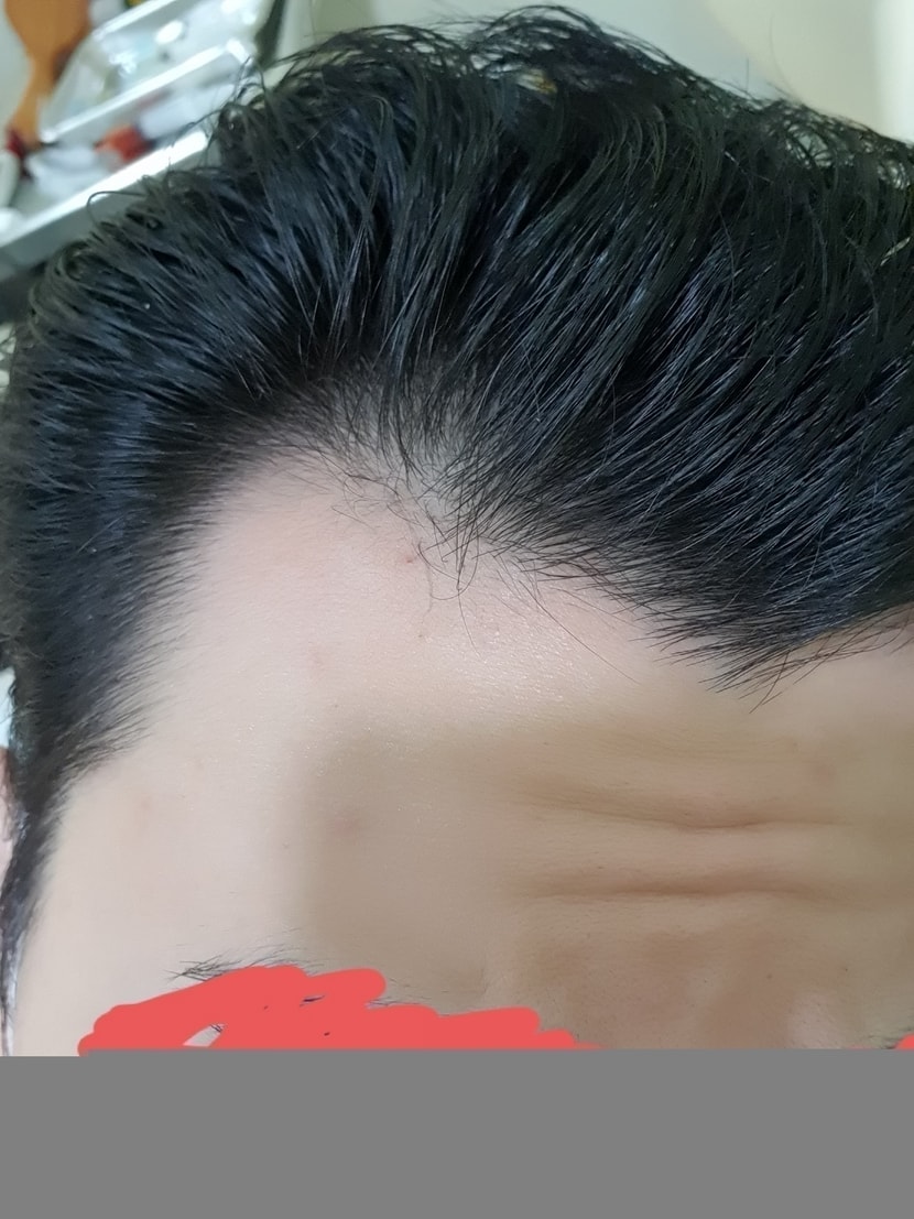 오른쪽
