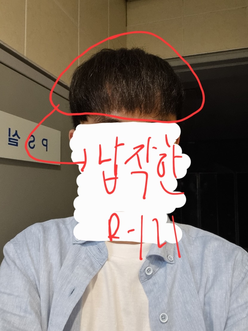 앞머리 쏟아내도 특유의 납작한 머리와 빈부분이 불만족스러워요..
