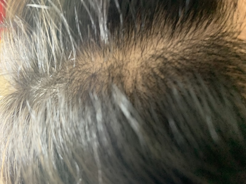 まつげ薄毛 お悩み