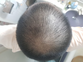 11개월 후 다시 반삭