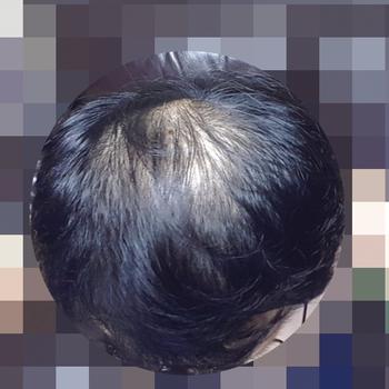 약복용전