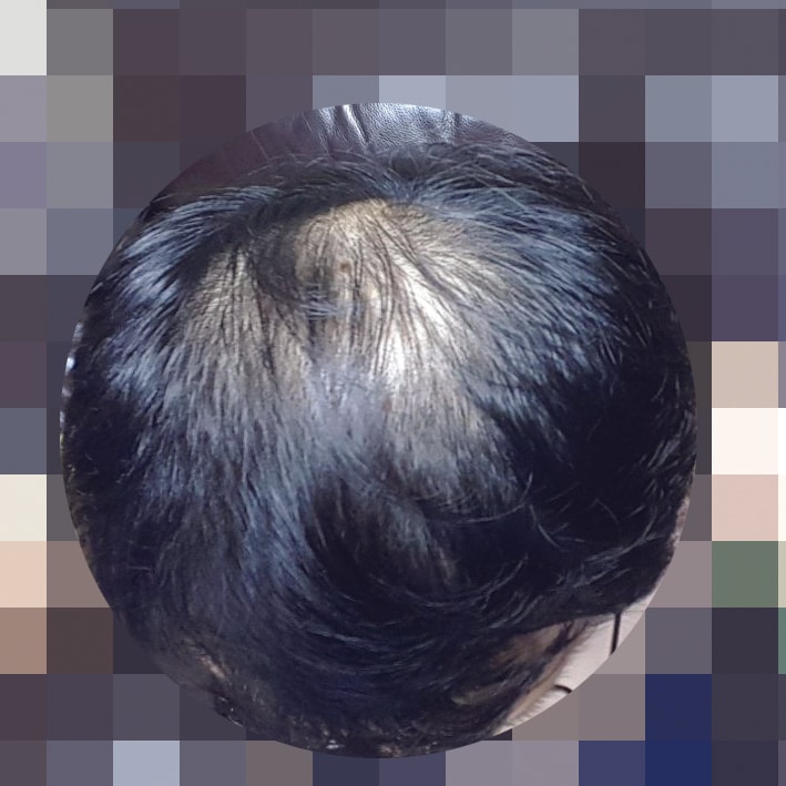 약복용전