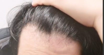 현재