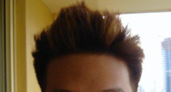 프로페시아 먹을 시간일까요?