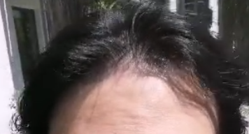 현재2