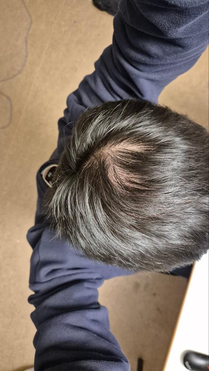 형님들 어쩝니까 이거