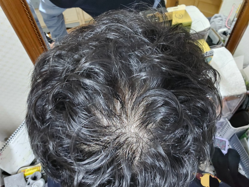 10월24일 입니다 이정도면 머리 감아야 하나요?