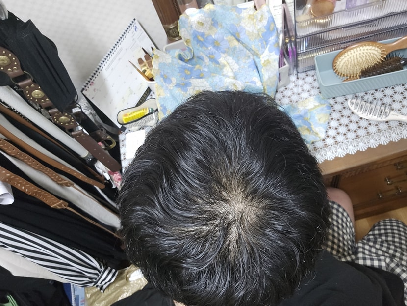 자고 일어나서 빗질 조금 한 머리 입니다...(10월23일)