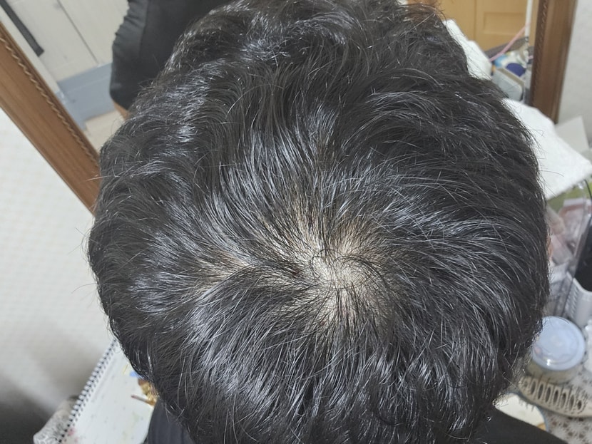 이게 오늘 아침 머리 자르기 전 입니다