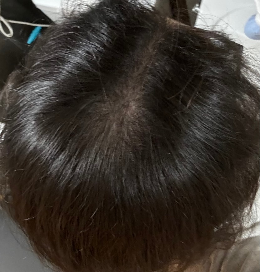 조명이 약할때