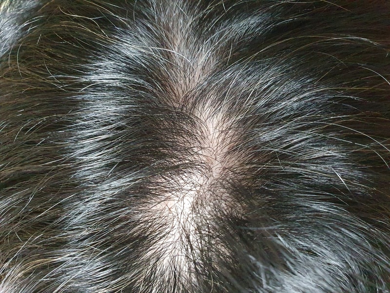 약 8개월째 기록용