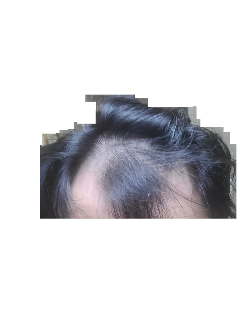피나 쉐딩이 맞을까요...? 제발 조언좀 해주세요