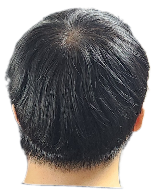 정수리