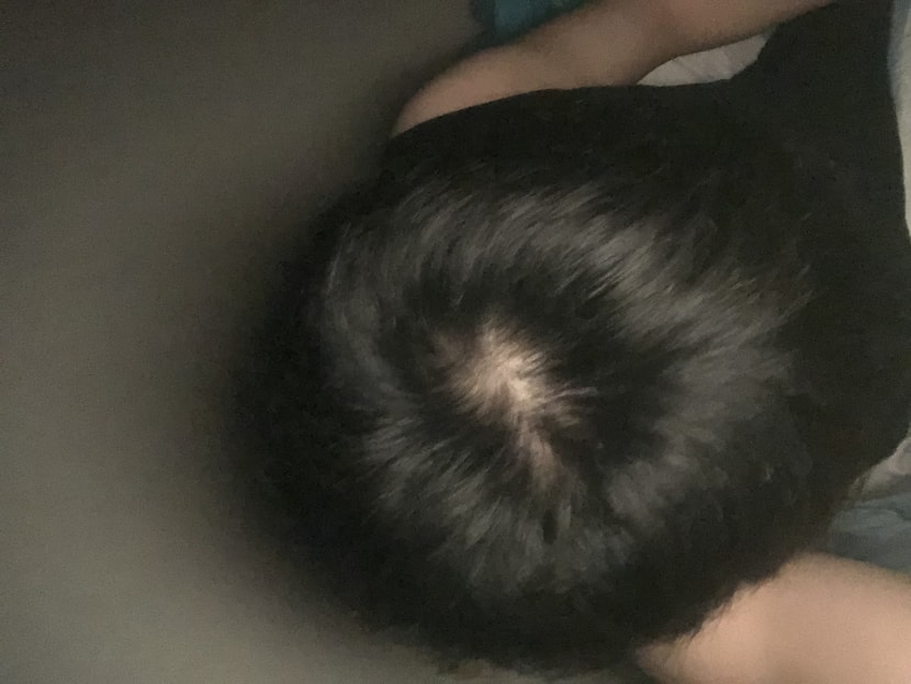 사진으로는 숱이 어느정도 있어보이는데 속알머리가 없어요