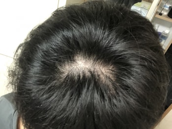 3개월 전