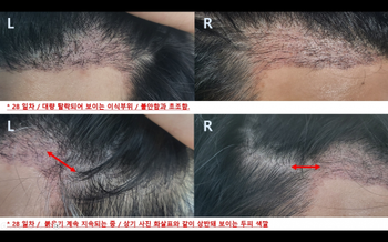28일차