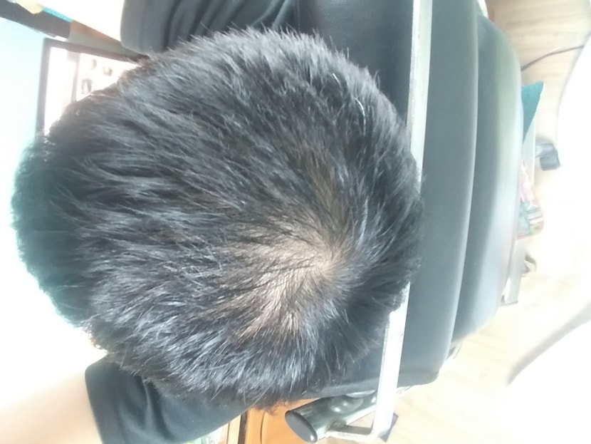 형광등 바로 아래에서