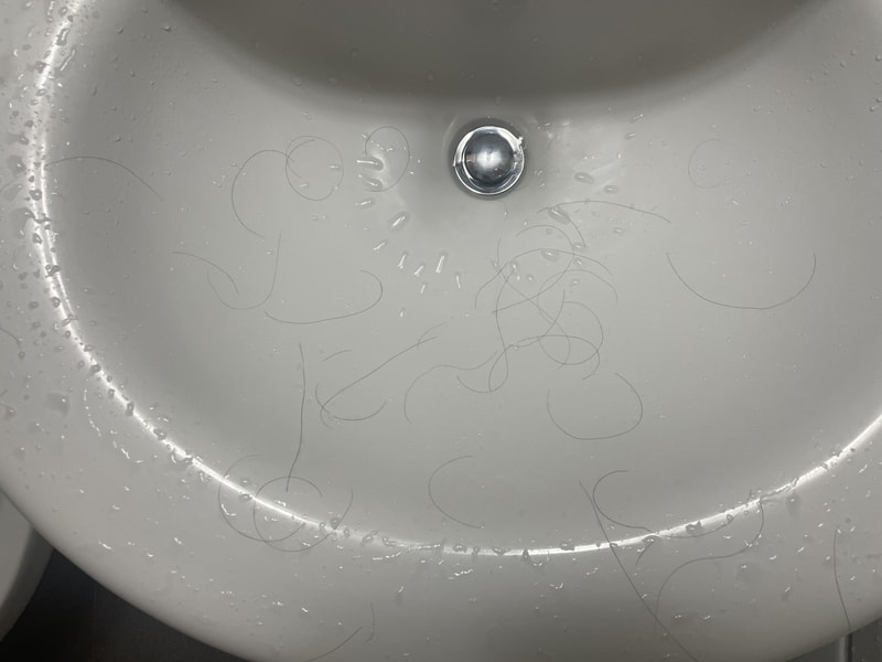 아보다트 6개월차 쉐딩 질문