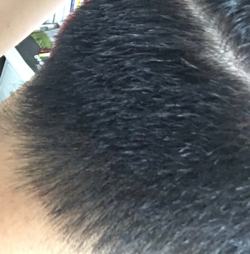 후
