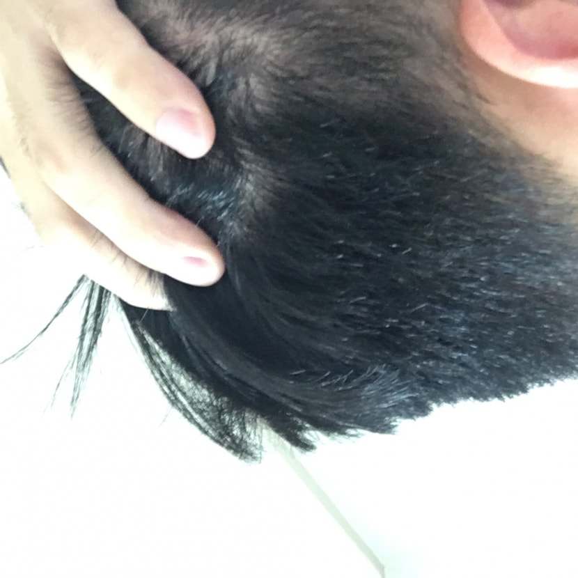 측